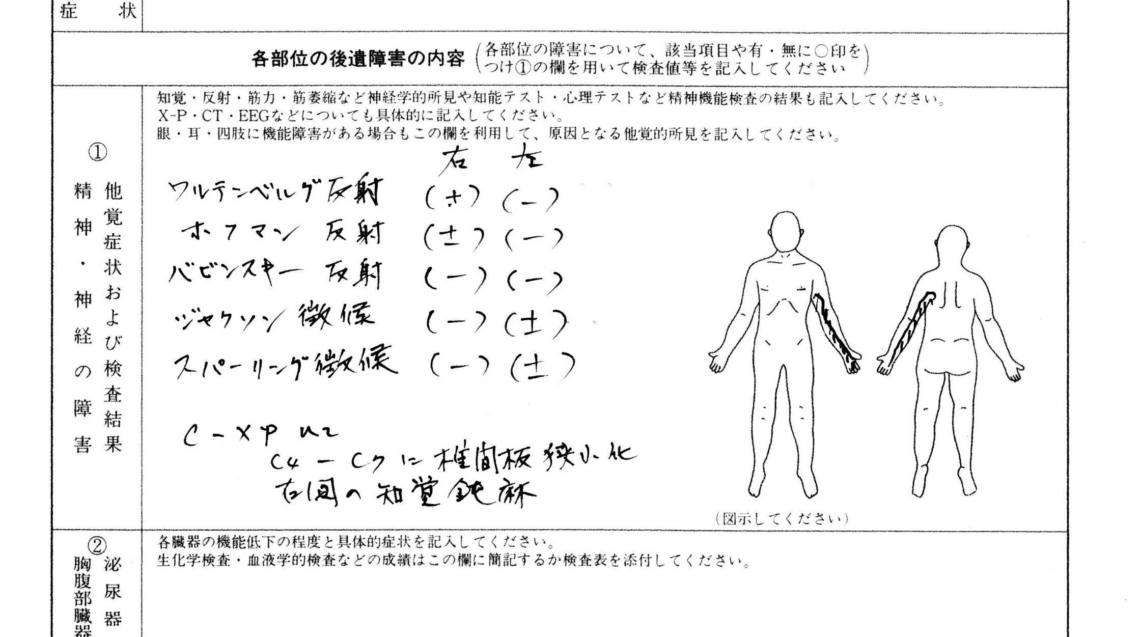 反射 は バビンスキー と